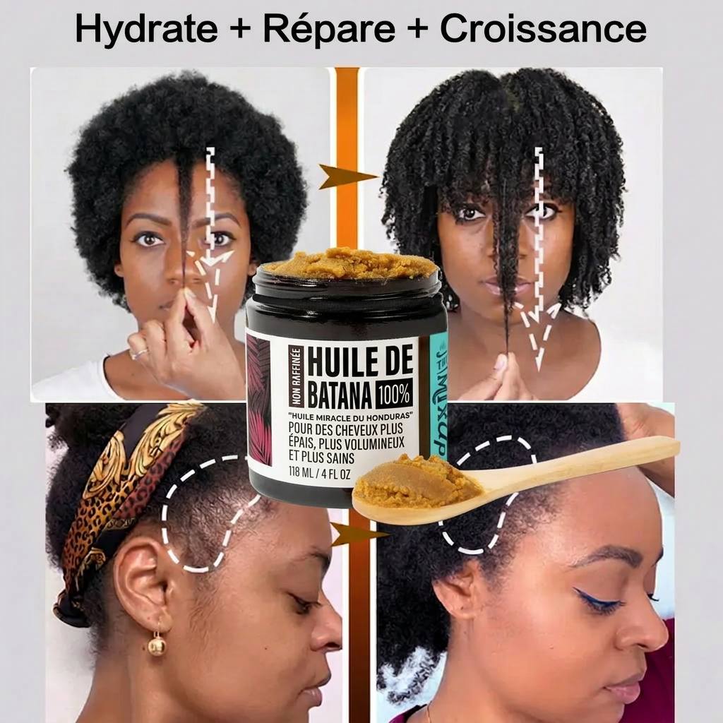 Stoppez la chute de cheveux et faites repousser vos tempes dégarnies en 14 jours — sans traitement chimique. (BN)